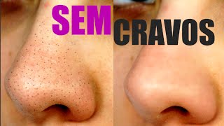 COMO REMOVER CRAVOS DO NARIZ  RECEITA CASEIRA VEDA8 [upl. by Addis236]