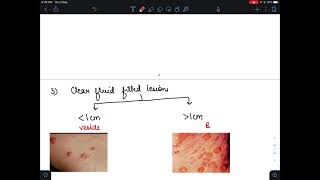 Dermatology primary lesions of dermatology [upl. by Arel]