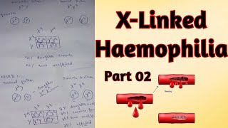 Genetics of X Linked Haemophilia disorder l Crossing of haemophilic couples lFor ClassXII and Mdcat [upl. by Ytsirt]