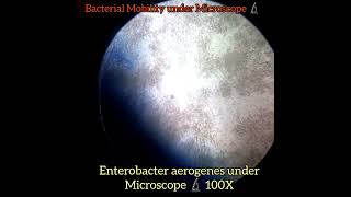 Enterobacter aerogenes under Microscope 🔬100X4501000X Bacteria  Klebsiella aerogenes [upl. by Hafeetal172]