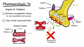 Migraines  Pathophysiology amp Treatment Described Concisely [upl. by Anahgem]