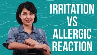 Beauty Edu Irritation vs Allergic Reaction [upl. by Vitale461]