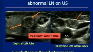 Thyroid Ultrasound Course [upl. by Newcomer569]