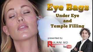 WATCH TEMPLE AND UNDER EYE INJECTIONS  Eye Bags and Wrinkle Treatment [upl. by Esiole768]