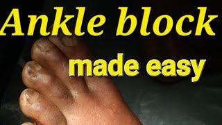 Ankle Block made Easyperfect Ankle block in 2 minutes Surgitube [upl. by Holton729]