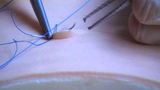 Subcuticular Suture Technique [upl. by Jacobba]