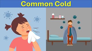 Microbiology of Common Cold Causes Symptoms and Relief [upl. by Aerdua]