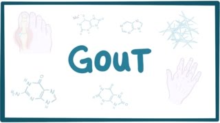 Gout  causes symptoms diagnosis treatment pathology [upl. by Eesac]