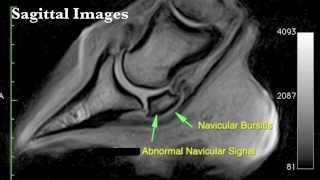 Standing MRI Information [upl. by Hanley]