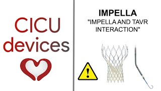 IMPELLA AND TAVRTAVI INTERACTION ALSO FOR SUTURELESS AND CALCIFIED AORTIC VALVES [upl. by Camarata]