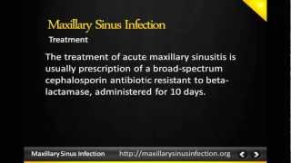 Maxillary sinus infection Maxillary sinus [upl. by Isaac]