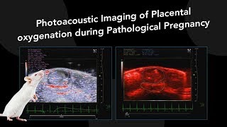 February 2018 Photoacoustic Imaging of Placental oxygenation during Pathological Pregnancy [upl. by Alecram56]