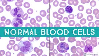 Normal Blood Cell Morphology neutrophil lymphocyte eosinophil erythrocyte plateletPeripheral Smear [upl. by Etterb]