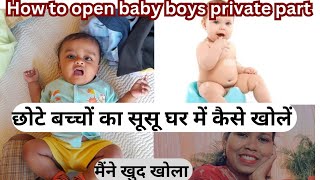 छोटे बच्चों का सूसू घर में कैसे खोलें   How To Open Baby Boys Praivet Part In Home 2024 [upl. by Riek278]