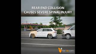 Rear End Collision Causes Severe Spinal Injury [upl. by Barney]