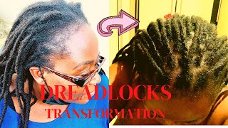 How to tighten locs with crochet needle New growth [upl. by Retsae770]