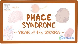 PHACE Syndrome Year of the Zebra [upl. by Estelle]