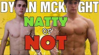 Dylan McKnight  NATTY or NOT [upl. by Asilahs128]