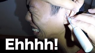 Attempting to Remove Hard Earwax with no Earwax Softener [upl. by Armillas]