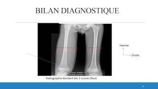 OSTEOMYELITE du STAFF vid [upl. by Silletram]