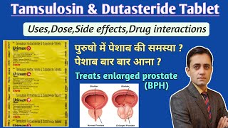 Tamsulosin hydrochloride and dutasteride tablet uses dose side effects in hindi  Urimax d tablet [upl. by Veta238]