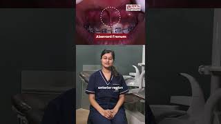 CaseOfTheWeek Conventional Frenectomy by Dr Arunima Bansal MDS Batch2023 🦷✨ [upl. by Dar]