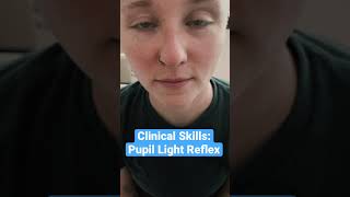 Pupil Light Reflex Clinical Skills  LevelUpRN [upl. by Corabelle]