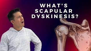 Scapular Dyskinesis and Shoulder Pain [upl. by Sabra433]