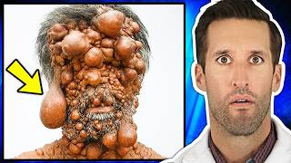 ER Doctor REACTS to Worlds Rarest Diseases PART 2 [upl. by Gorrian]