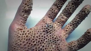 Trypophobia Test  Do you have a fear of small holes [upl. by Freddie]