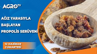 Ağız Yarasıyla Başlayan Propolis Serüveni  Arı Terapi  Agro TV [upl. by Bore695]