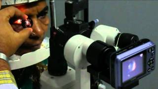 Aravind Slit Lamp Camera March 2012 [upl. by Lednew265]