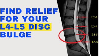 10 Things L4L5 Disc Bulge Patients Need to Know for a Speedy Recovery  Dr Walter Salubro [upl. by Latimer]