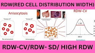 RDWRED CELL DISTRIBUTION WIDTH RDW SDRDW CVNORMAL RANGESHIGH RDWRDW AND ANEAMIA RDW FORMULA [upl. by Ayaladnot]