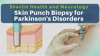 Get to Know About Skin Punch Biopsy for Alpha Synuclein Protein at Sharlin Health and Neurology [upl. by Eshman]