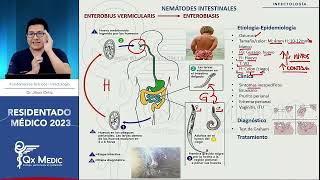 RM 2023 Infecto 2 Trichuriasis Enterobius Ascaris Strongyloides uncinaria Trichinela Filarias [upl. by Dorahs678]