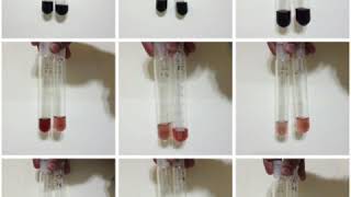 Alpha amylase colour development in assay determination [upl. by Notsreik]