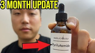 MY 3 MONTH UPDATE ON PYRILUTAMIDE KX826 [upl. by Iand]