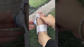 Part 146 bigfootboneprotrusion thumbvalgus separate toesviralvideoytshorts [upl. by Arlene]