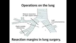 LECTURE 07 THORACIC SURGERY [upl. by Aliakam]