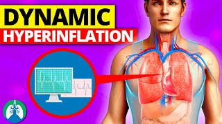 Dynamic Hyperinflation Medical Definition  Quick Explainer Video [upl. by Elleinwad]