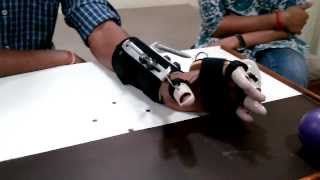 DHS Dynamic Hand Splint spastic hand splint [upl. by Lairea]