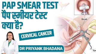 Pap Smear Test पैप स्मीयर टेस्टक्या है  Cervical Cancer Test  Best Gynaecologist in Gurgaon [upl. by Ayt]