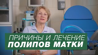 Полипы матки Причины и лечение полипов [upl. by Clute]