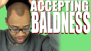 Accepting Your Baldness [upl. by Dustan]