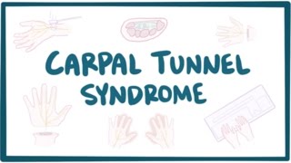 Carpal tunnel syndrome  causes symptoms diagnosis treatment amp pathology [upl. by Weatherby]