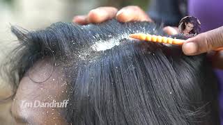 Oddly Satisfying Insane Dandruff Scratching Flakes Scalp Condition Removal After Braids 𝐈𝐌𝐃𝟑𝟗𝟗𝟎𝟗𝟕𝟎 [upl. by Ailis]