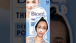 Blackheads whiteheads removal at home skincaregoals skincare Nosestrips shortsfeed pores [upl. by Dietsche]