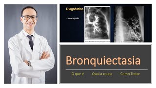 Bronquiectasia [upl. by Bluma]