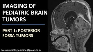 Imaging of Pediatric Brain Tumors part 1 Posterior fossa tumors [upl. by Airdnal]